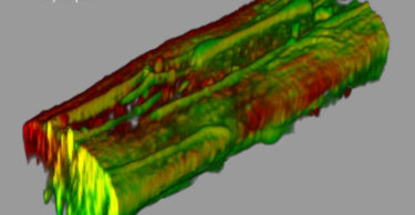 Biofilm unter dem Mikroskop