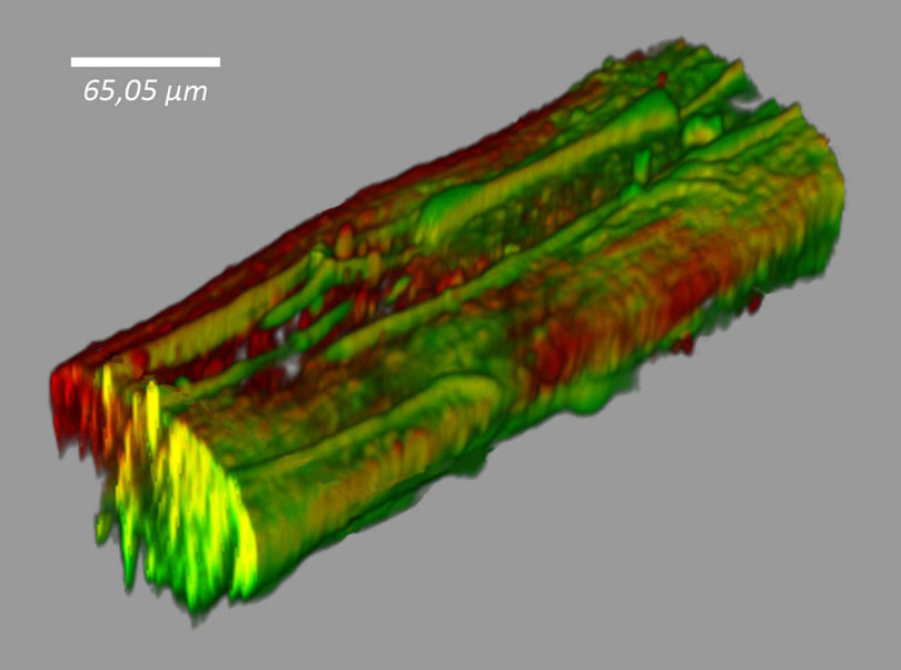 Biofilm unter dem Mikroskop